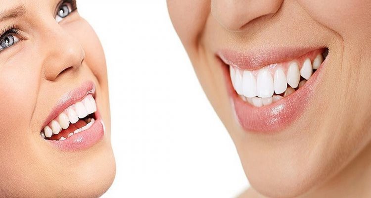 blanqueamiento dental en burjassot, dientes blancos, tratamientos de estética dental