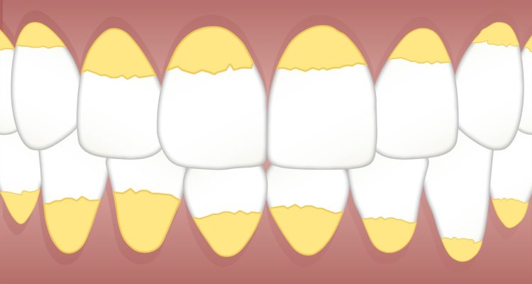 sarro dental